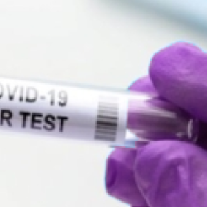 RT-PCR COVID-19 Test